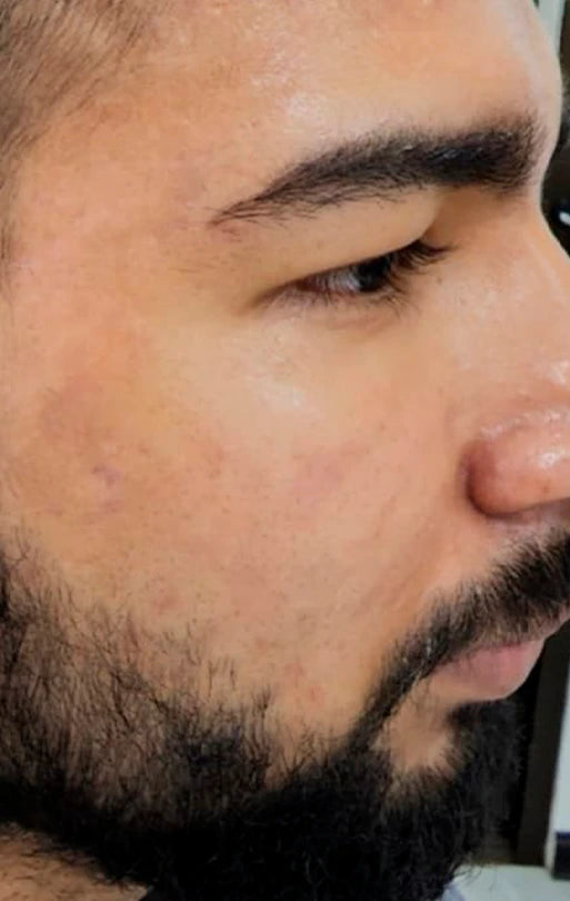 DESPUÉS